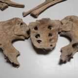 ...le scapole, le braccia e la base del bacino